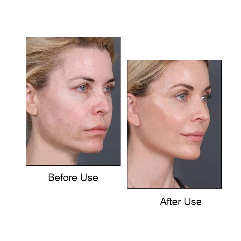 Masque gainant visage - Effet V-Lift - Pour lifting du visage, resserrage des rides, réducteur de double menton